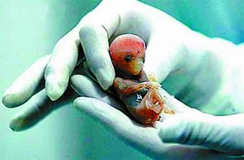 Fig.01